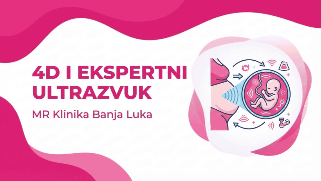 4D Ultrazvuk i Ekspertni Ultrazvuk Beba Banja Luka (VODIČ ZA TRUDNICE)