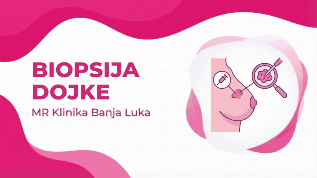 Biopsija dojke Banja Luka Centru za dojku MR Klinika