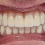 All on 4 primjer rada 5 final