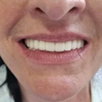 All on 4 primjer rada 5 final 2