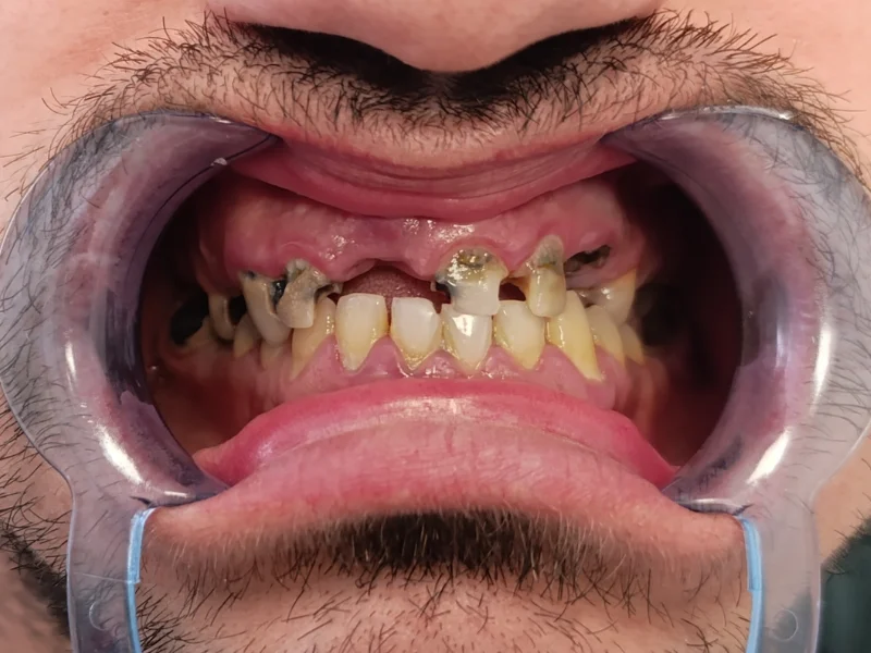 All on X prije ugradnje 1