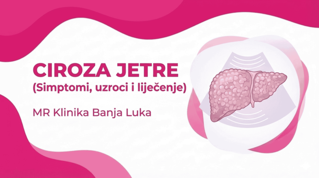 Ciroza Jetre (SIMPTOMI, UZROCI, LIJEČENJE I DIJAGNOSTIKA)