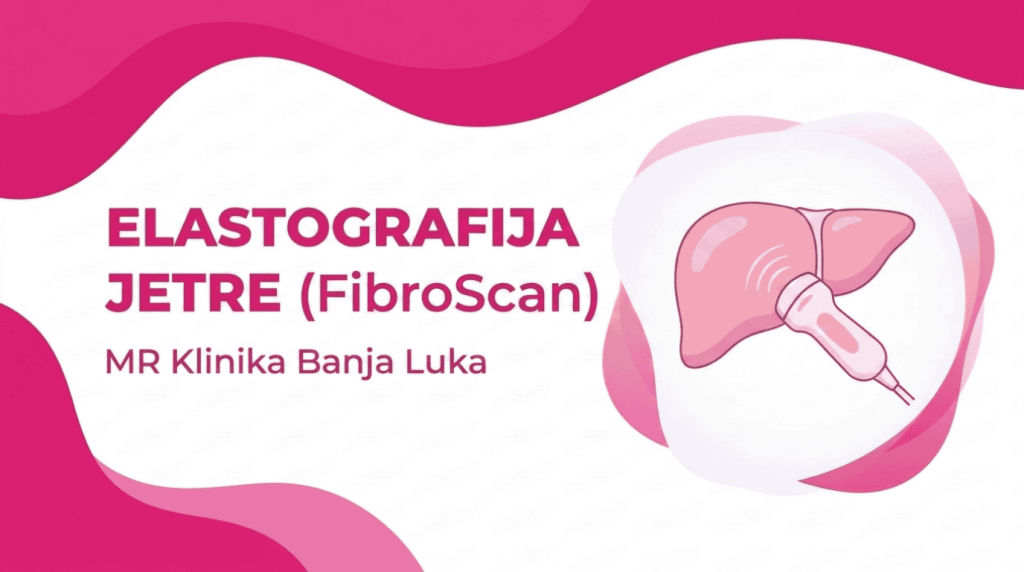 Elastografija Jetre (FibroScan) MR Klinika Banja Luka