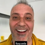 Hollywood smile pac 2