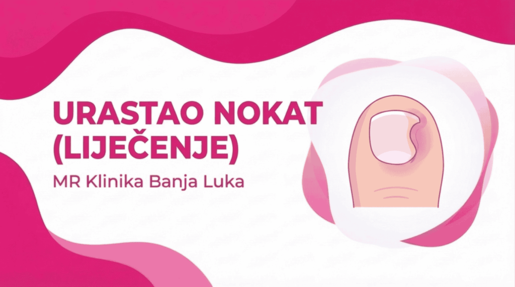 Urastao Nokat (LIJEČENJE, UZROCI I PREVENCIJA)