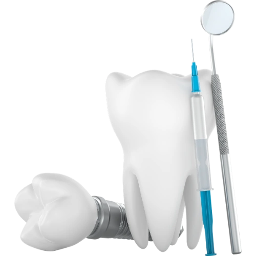 zygomatic implant pic