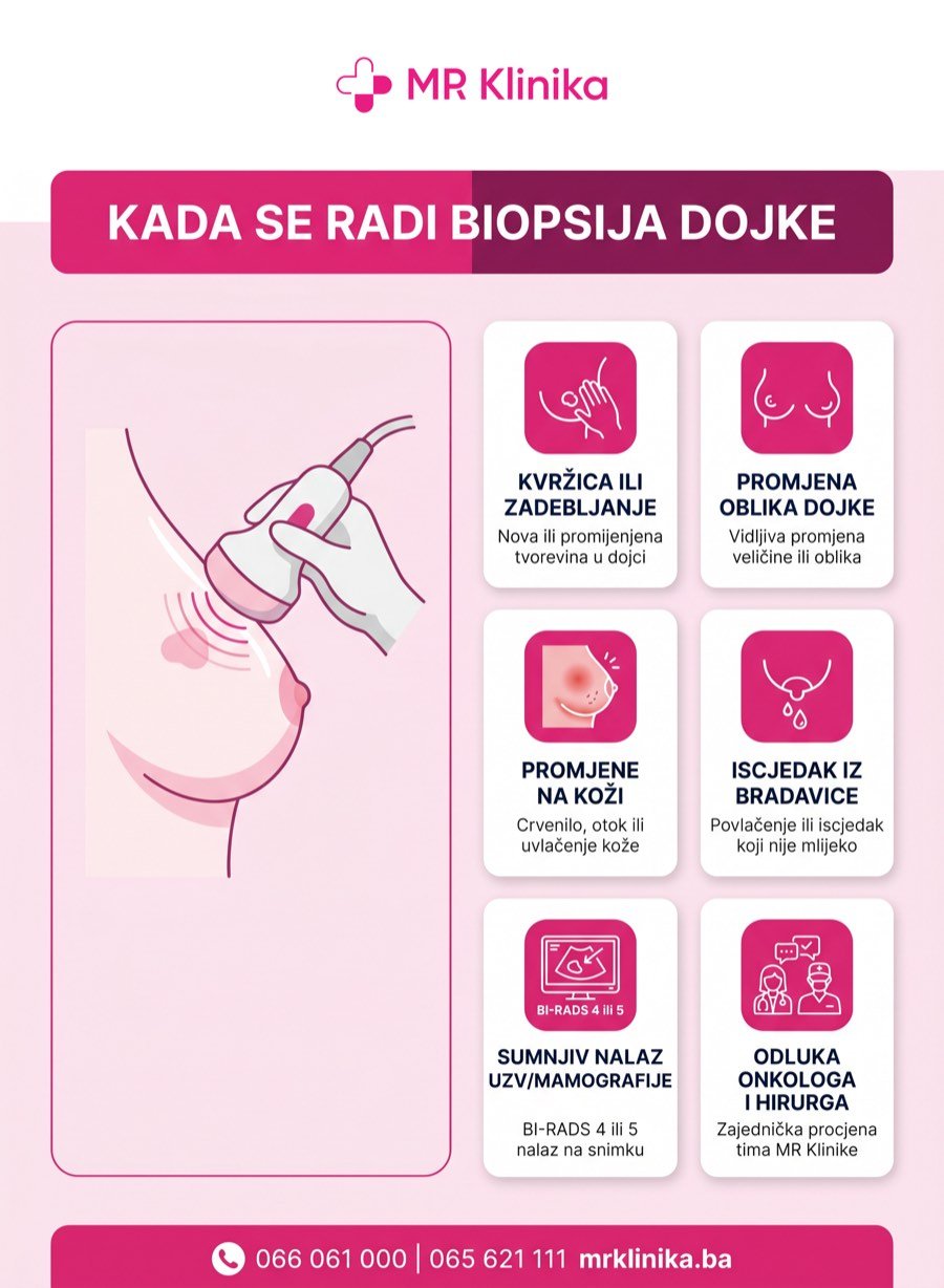 Kada se radi biopsija dojke - indikacije za biopsiju u MR Klinici