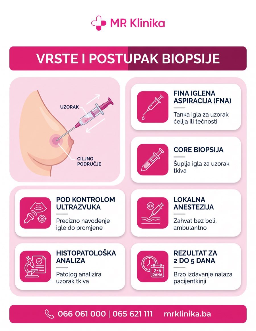 Vrste i postupak biopsije dojke - FNA i core biopsija u MR Klinici
