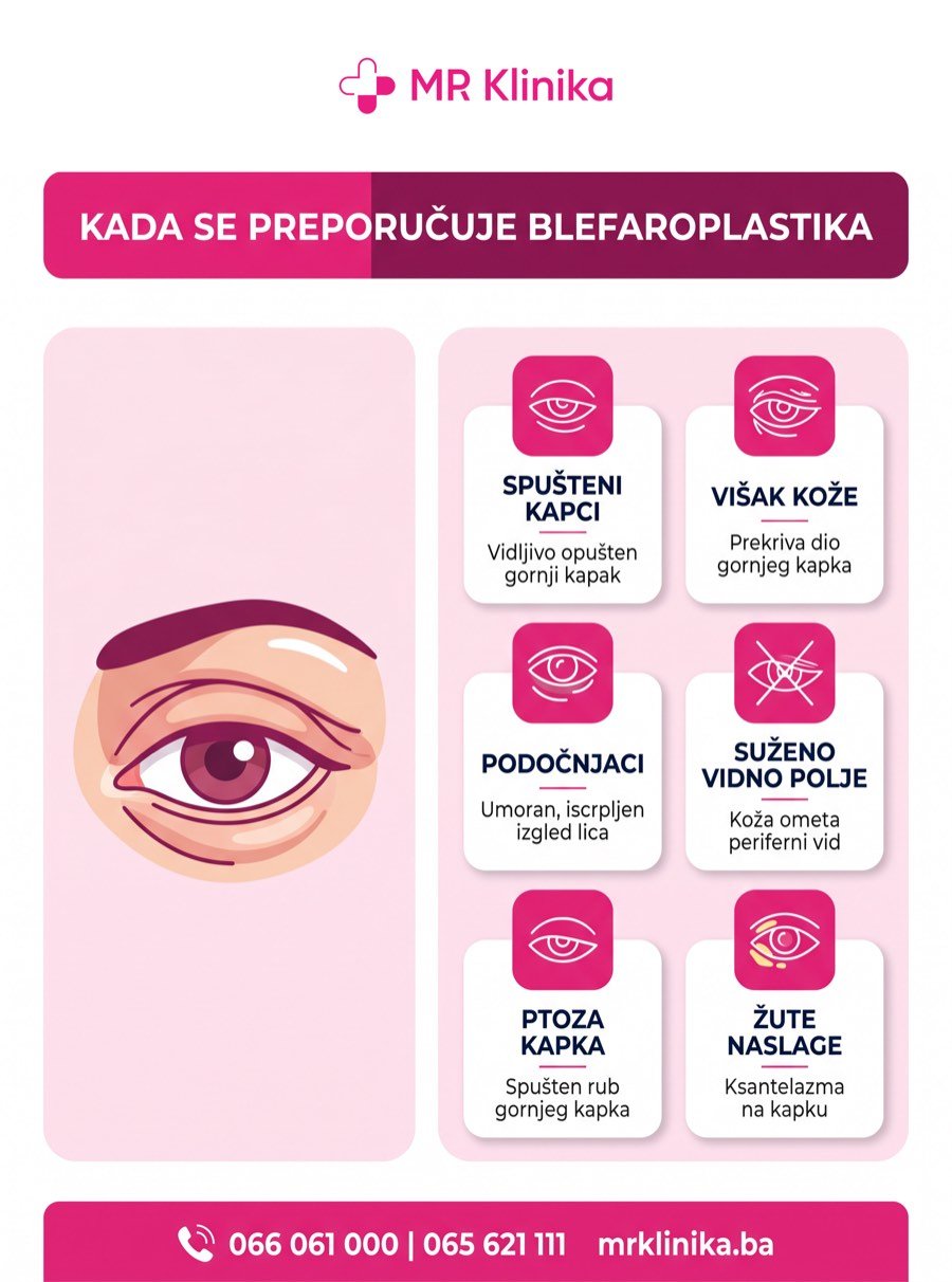 Kada se preporučuje blefaroplastika - indikacije za operaciju kapaka MR Klinika