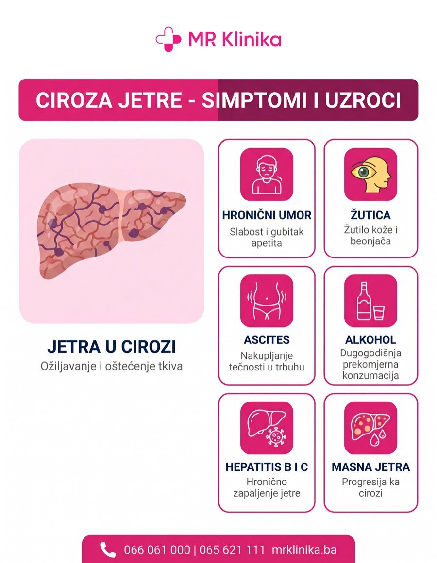 Ciroza jetre - simptomi i uzroci infografika, MR Klinika Banja Luka