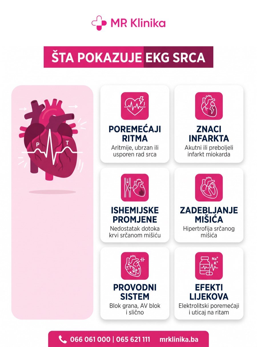 Šta pokazuje EKG srca - infografika MR Klinika