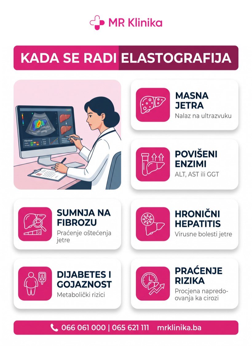 Kada se radi elastografija jetre