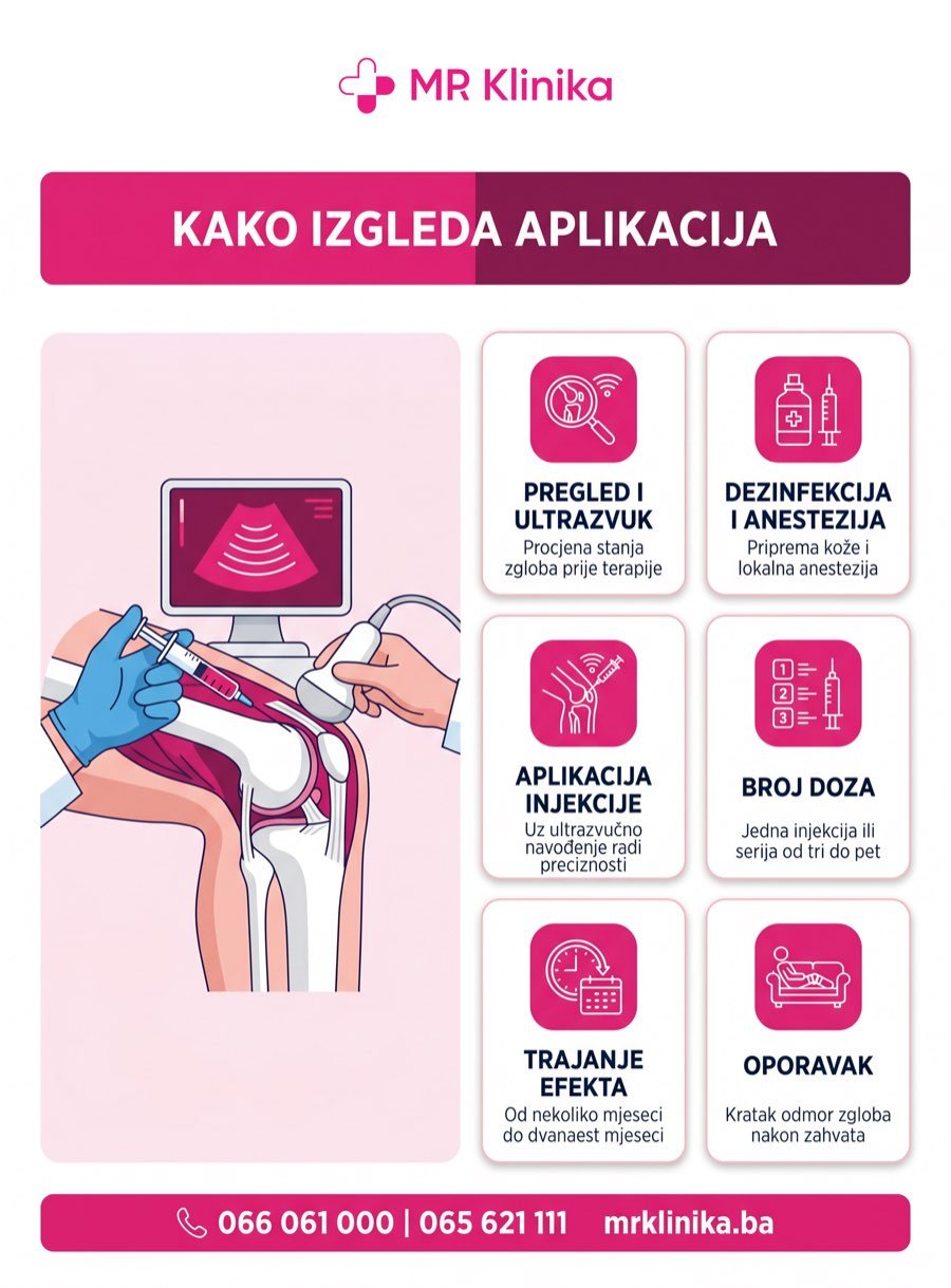 Kako izgleda aplikacija hijaluronske kiseline u koljeno - proces