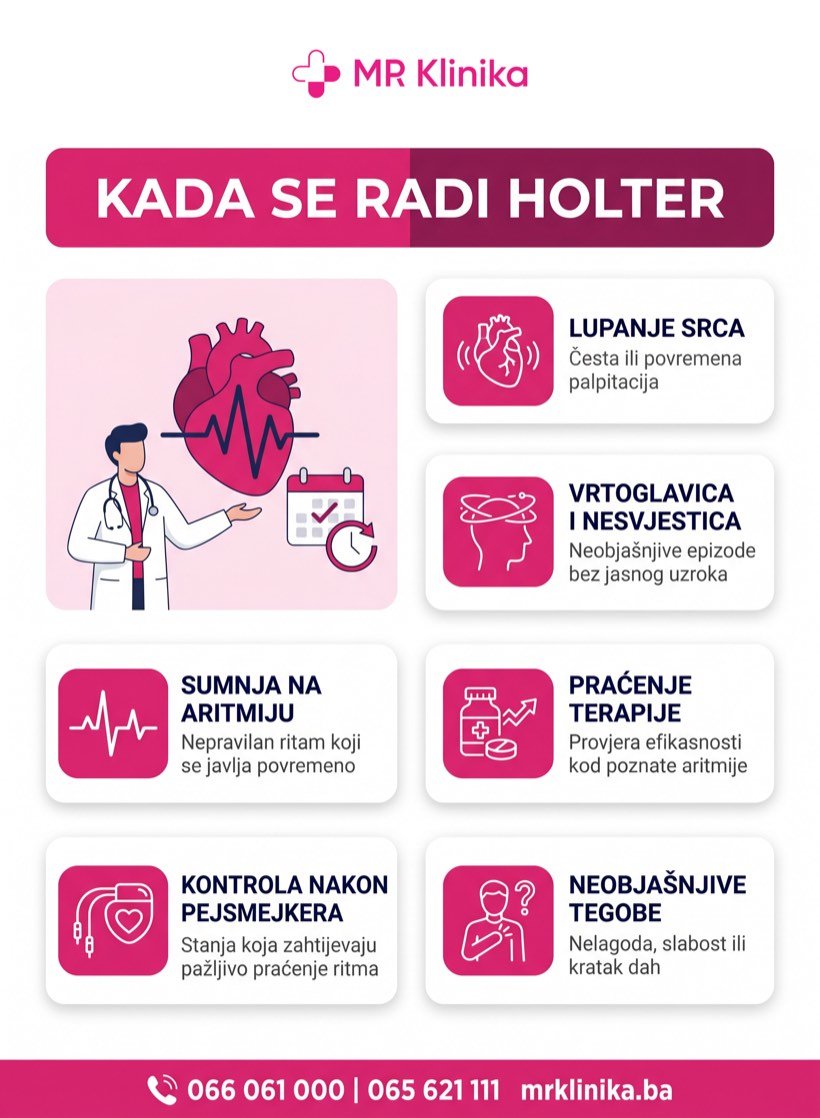 Kada se radi Holter EKG - indikacije za kardiološki pregled