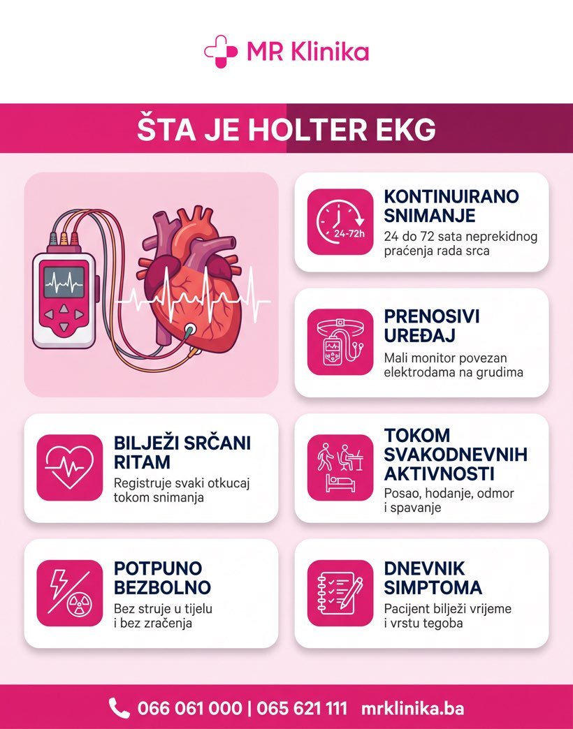 Šta je Holter EKG - kontinuirano praćenje rada srca