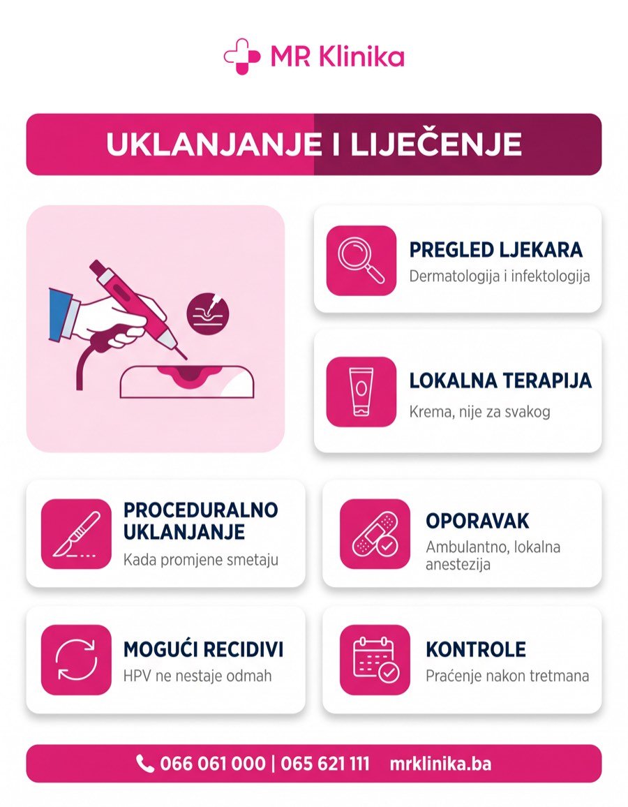 Uklanjanje i liječenje kondiloma - MR Klinika Banja Luka