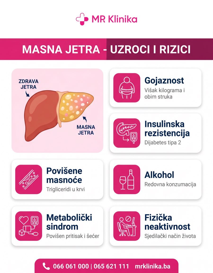 Masna jetra uzroci i faktori rizika - MR Klinika Banja Luka