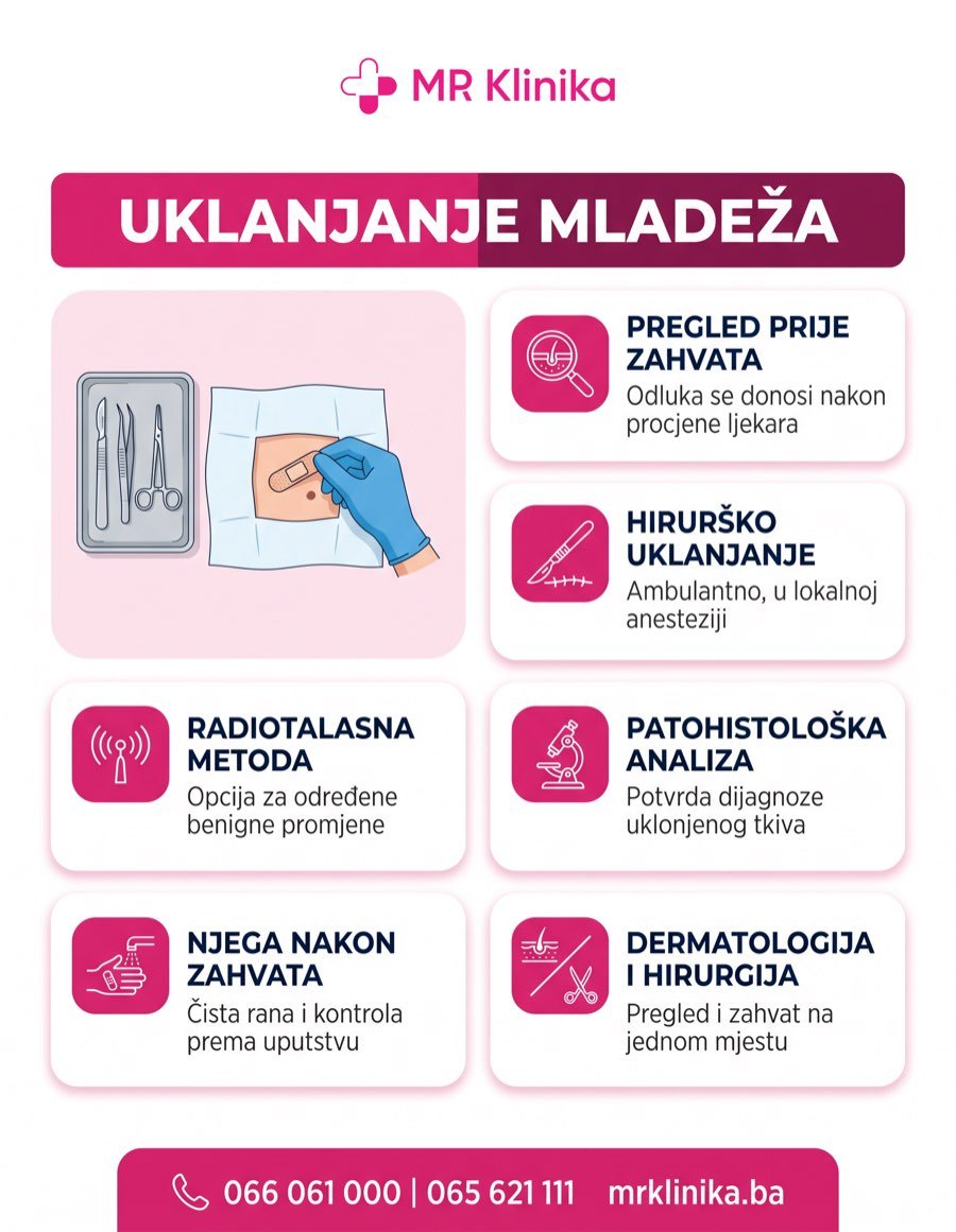 Uklanjanje mladeža - metode i postupak
