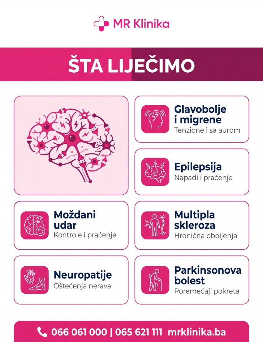 Šta liječi neurolog - glavobolje, epilepsija, moždani udar, multipla skleroza, neuropatije, Parkinsonova bolest