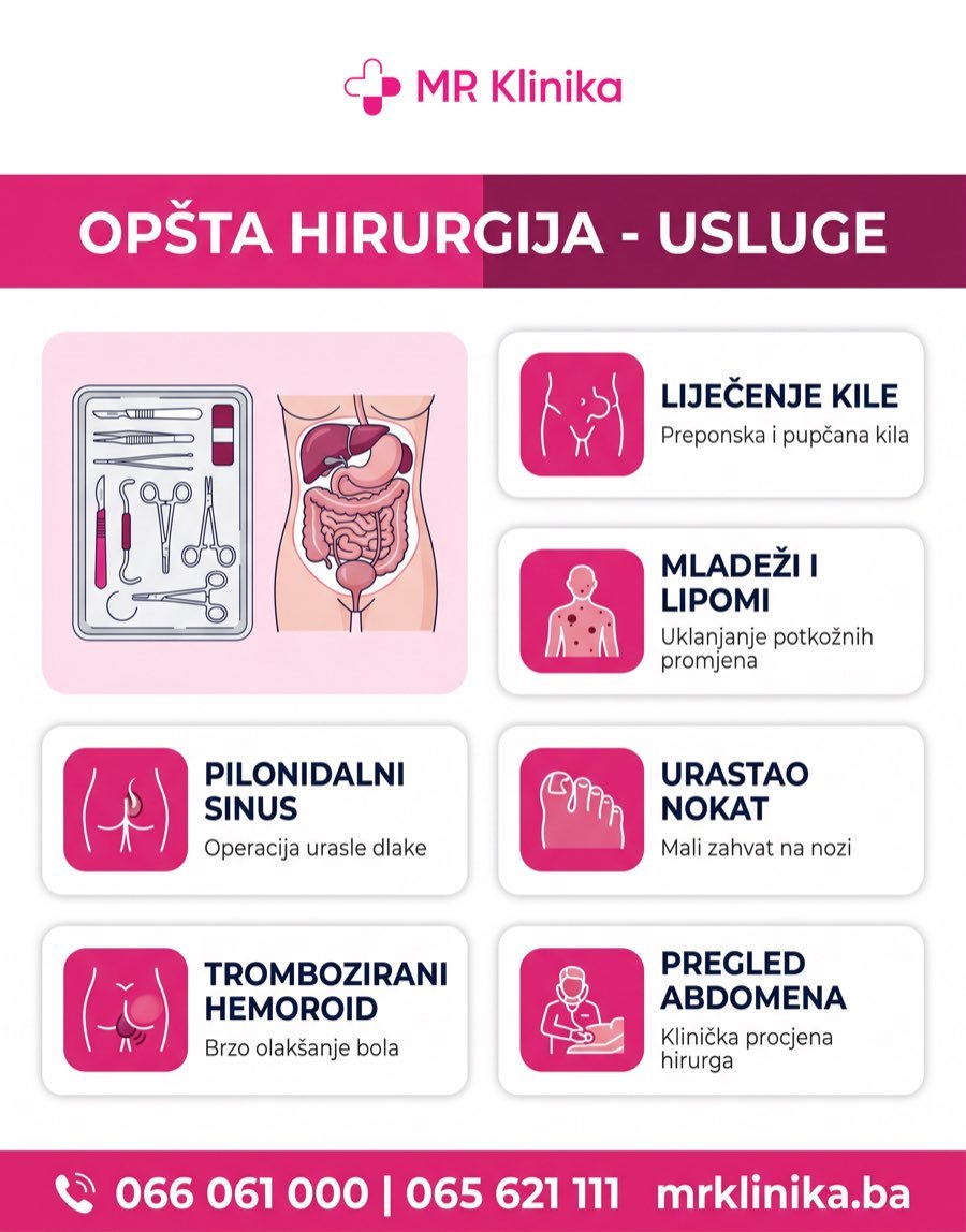 Opšta hirurgija Banja Luka - usluge MR Klinika