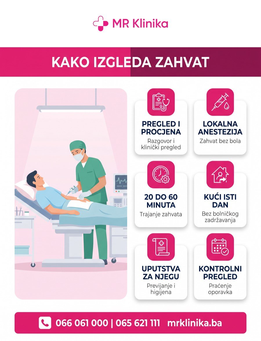 Kako izgleda hirurški zahvat u MR Klinika
