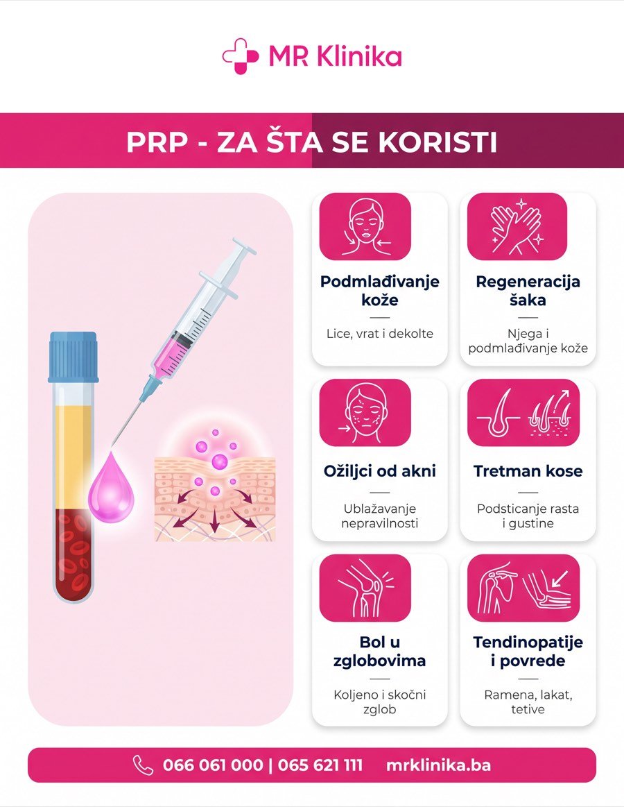 PRP tretman krvnom plazmom - primjena (koža, kosa, zglobovi) MR Klinika