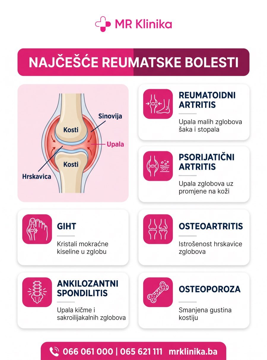 Najčešće reumatske bolesti - reumatoidni artritis, psorijatični artritis, giht, osteoartritis, ankilozantni spondilitis, osteoporoza