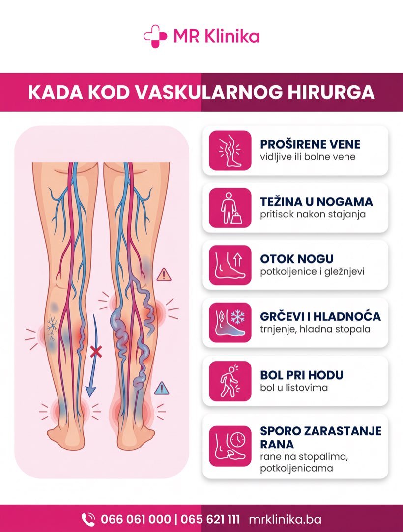 Kada se javiti vaskularnom hirurgu - proširene vene, otok, bol pri hodu, spor zarastanje rana