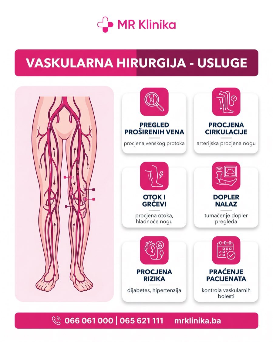 Usluge vaskularne hirurgije - pregled, procjena cirkulacije, dopler nalaz, praćenje pacijenata