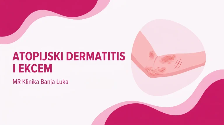 Atopijski dermatitis i ekcem u pregibu lakta - suha, crvena koža koja se ljušti, ilustracija, MR Klinika Banja Luka