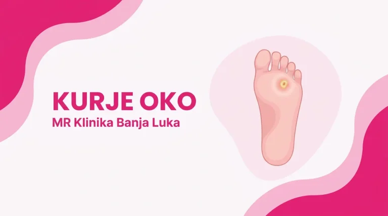 Kurje oko na tabanu - uzroci, simptomi i uklanjanje, MR Klinika Banja Luka