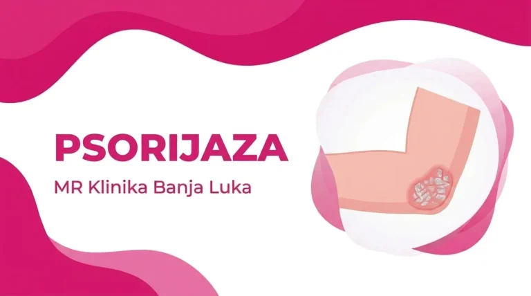 Psorijaza na laktu - plak sa ljuskom, ilustracija, MR Klinika Banja Luka