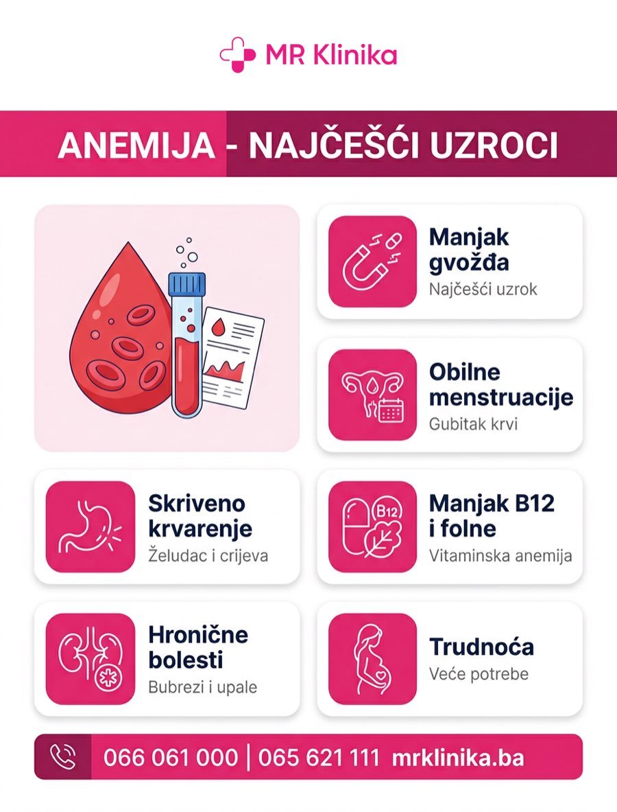 Najčešći uzroci anemije - manjak gvožđa, obilne menstruacije, skriveno krvarenje, manjak B12 i folne, hronične bolesti i trudnoća