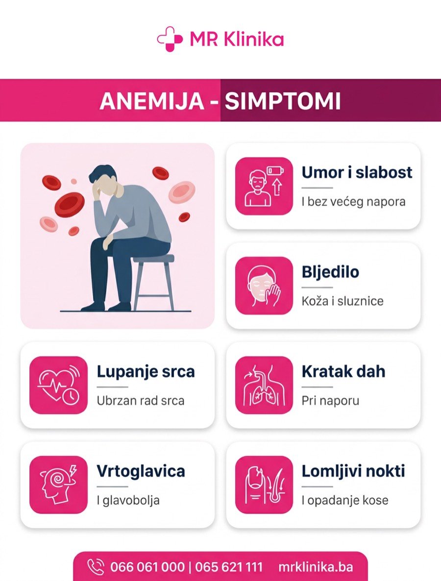 Simptomi anemije - umor, bljedilo, lupanje srca, kratak dah, vrtoglavica i lomljivi nokti