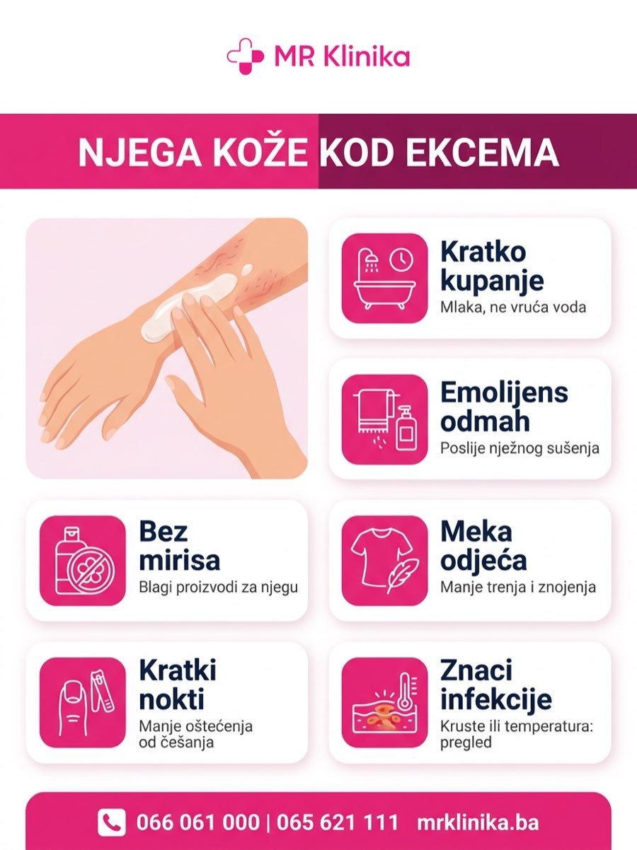Njega kože kod ekcema: kratko kupanje, emolijens odmah, bez mirisa, meka odjeća, kratki nokti, znaci infekcije - MR Klinika Banja Luka