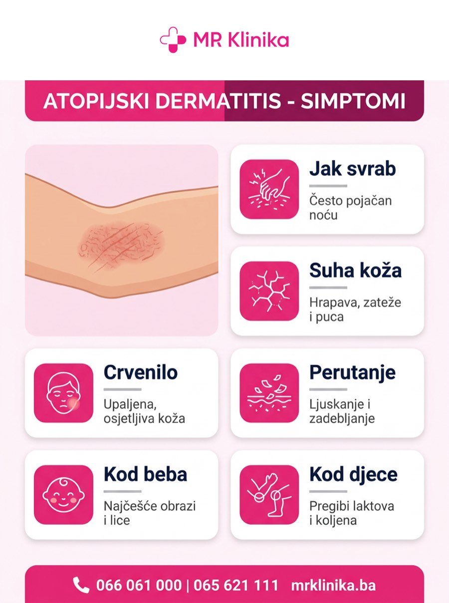 Atopijski dermatitis - simptomi: jak svrab, suha koža, crvenilo, perutanje, kod beba obrazi i lice, kod djece pregibi - MR Klinika Banja Luka