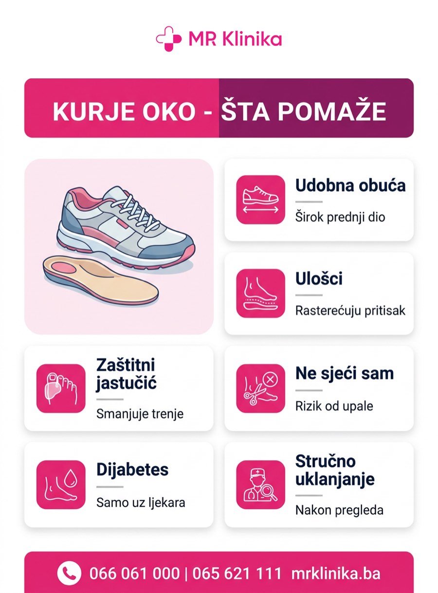 Šta pomaže kod kurjeg oka - udobna obuća, ulošci, zaštita od trenja i stručno uklanjanje